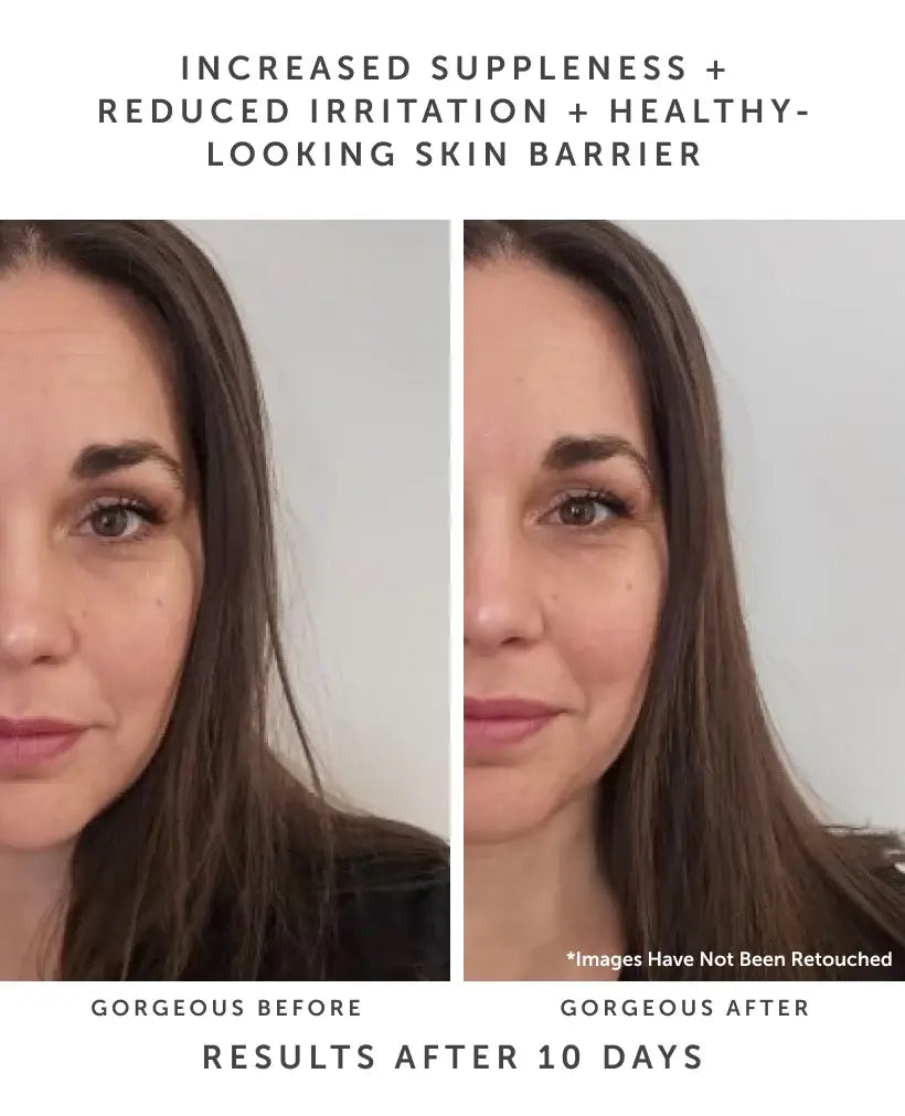 HORIZON Ceramide Repair Serum: Ceramide Complex