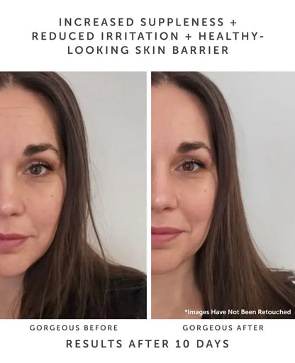 HORIZON Ceramide Repair Serum: Ceramide Complex